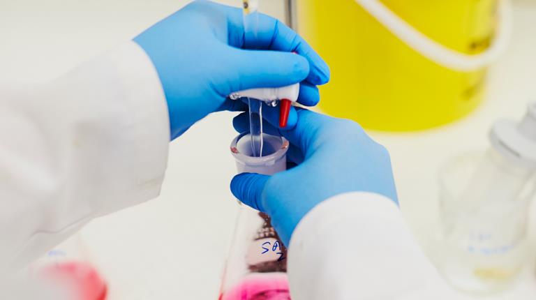 Gloved hands on lab beaker